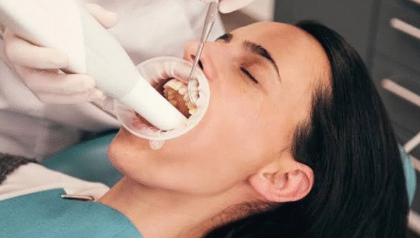 How General Dentists Help Protect Teeth From Everyday Wear